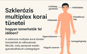 szklerózis multiplex korai tünetei